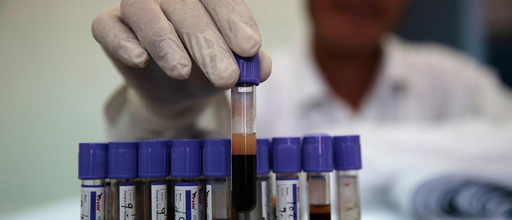 Επίτευγμα Έλληνα επιστήμονα: τεστ αίματος “βλέπει” 8 είδη καρκίνου