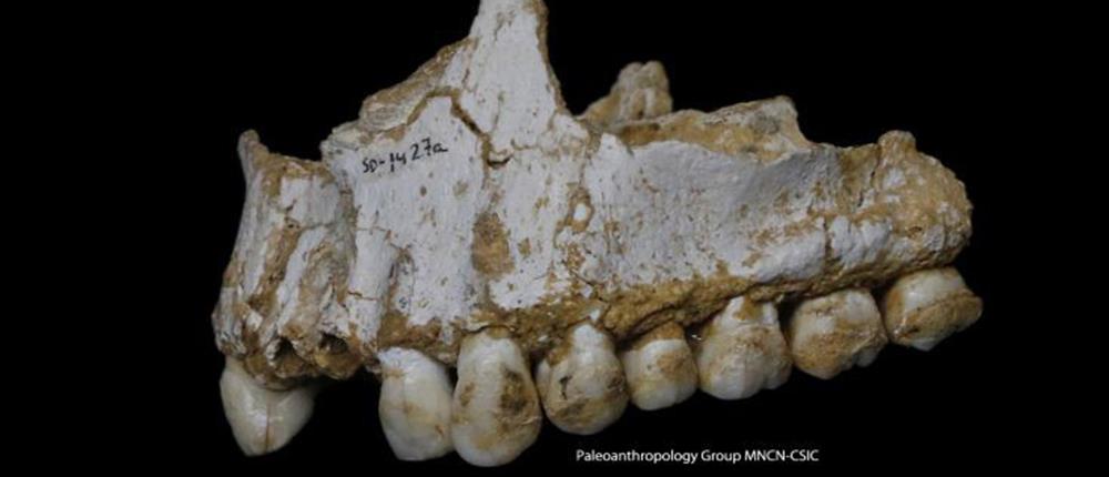 Η Οδοντιατρική στους προϊστορικούς χρόνους - Οι Νεάντερταλ ήταν οδοντίατροι;