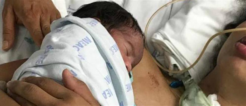 Ξύπνησε από το κώμα όταν της έβαλαν το νεογέννητο μωρό της στην αγκαλιά