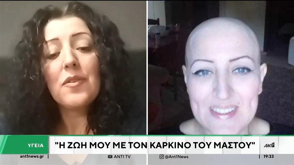 Καρκίνος Μαστού: "Η ζωή μου μετά την διάγνωση"