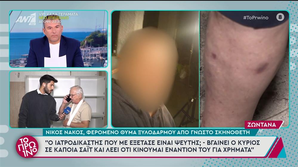 Ο Νίκος Νάκος, φερόμενο θύμα ξυλοδαρμού από γνωστό σκηνοθέτη, στο Πρωινό - 30/10/2024