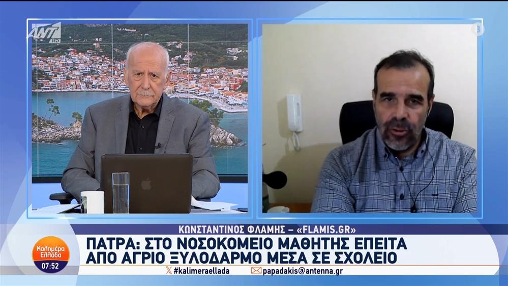 Πάτρα: Στο νοσοκομείο μαθητής έπειτα από άγριο ξυλοδαρμό σε σχολείο  - Καλημέρα Ελλάδα - 16/10/2024
