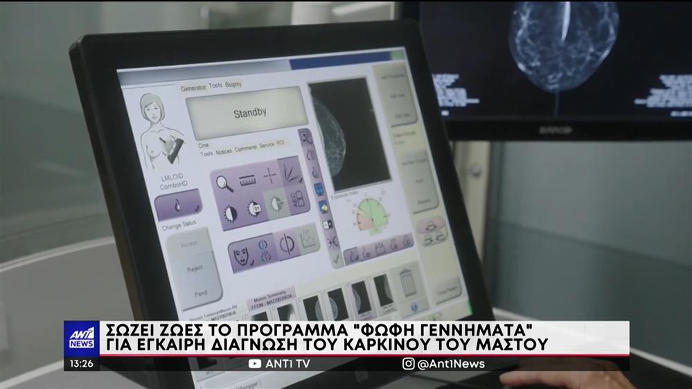 ΣΦΕΕ: Το Ευρωπαϊκό Σχέδιο Καταπολέμησης του Καρκίνου και οι προκλήσεις για την Ελλάδα