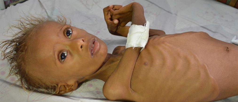 Υεμένη: πάνω από 11 εκατ. παιδιά έχουν απελπιστική ανάγκη βοήθειας