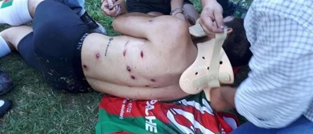 Η αστυνομία “γάζωσε” ποδοσφαιριστές με πλαστικές σφαίρες