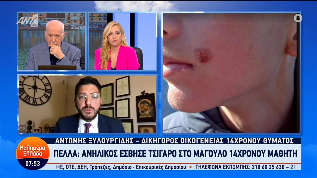 Πέλλα: Ανήλικος έσβησε τσιγάρο στο μάγουλο 14χρονου μαθητή – Καλημέρα Ελλάδα – 25/04/2024