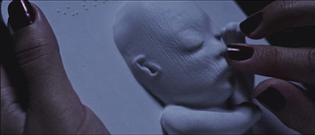Τυφλή μητέρα «είδε» για πρώτη φορά το αγέννητο μωρό της (βίντεο)
