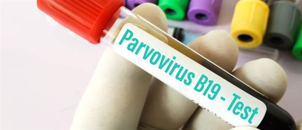 Παρβοϊός: Συμπτώματα, διάγνωση και αντιμετώπιση