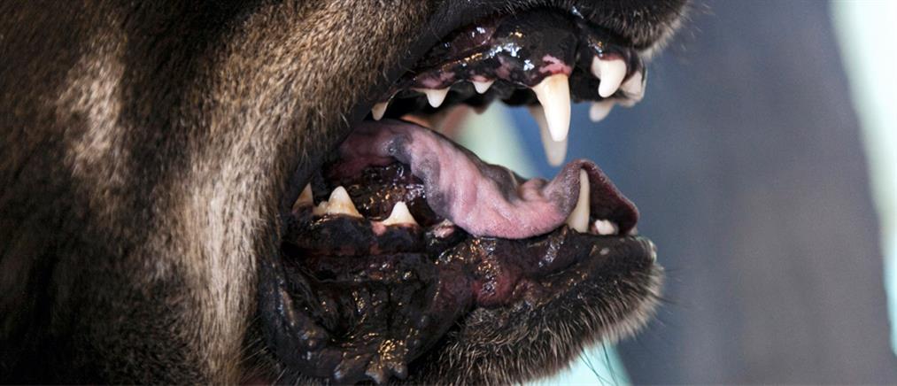 Αγρίνιο: Σκύλος τραυμάτισε σοβαρά παιδί - Διακομίστηκε στην Πάτρα