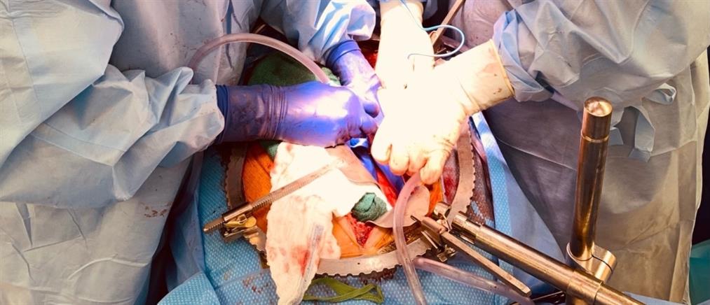 Μεταμόσχευση νεφρών χοίρου σε εγκεφαλικά νεκρό άνθρωπο (εικόνες)