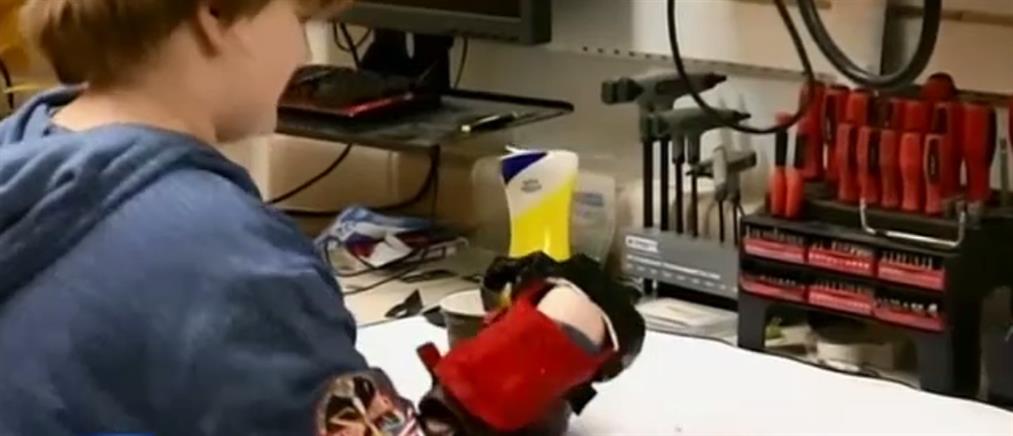 Χέρια από τρισδιάστατο εκτυπωτή απέκτησε αγόρι 11 ετών (βίντεο)