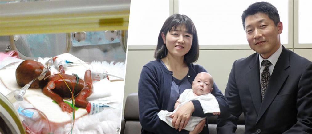 Κέρδισε τη “μάχη” για τη ζωή ένα μωρό που γεννήθηκε… 258 γραμμάρια! (εικόνες)