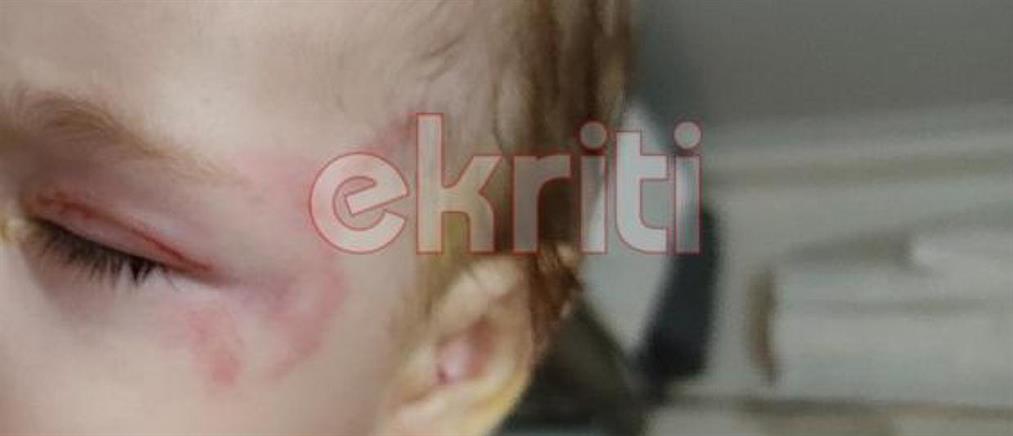 Κρήτη: Εικόνες - σοκ από την επίθεση σκύλου σε γιαγιά και το εγγονάκι της