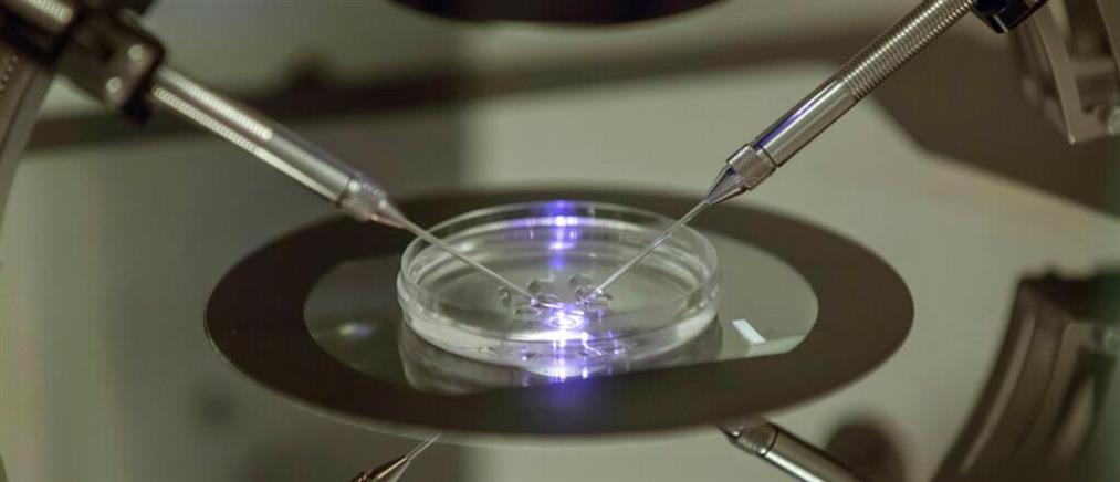 Mini-IVF: Έμφαση στην ποιότητα των ωαρίων