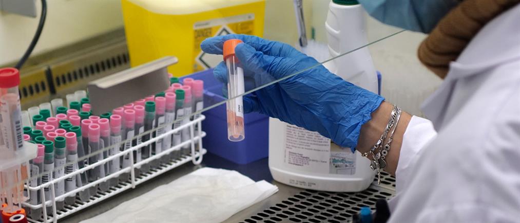 Κορονοϊός - Γκάγκα: όχι μοριακό τεστ για εμβολιασμένους εργαζόμενους