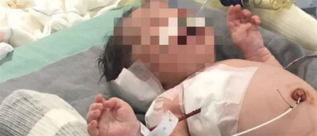 Μωρό τραυματίστηκε από αδέσποτη σφαίρα μέσα στην κοιλιά της μαμάς του