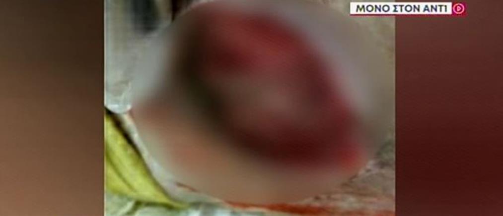 Χανιά - Γηροκομείο: εικόνες σοκ από τρόφιμους με κατακλίσεις (βίντεο)