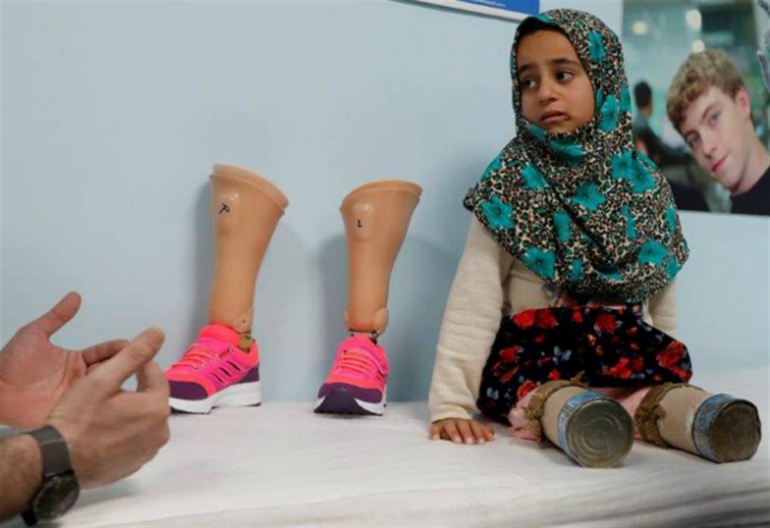 Συρία - 8χρονη - κονσερβοκούτια - πόδια