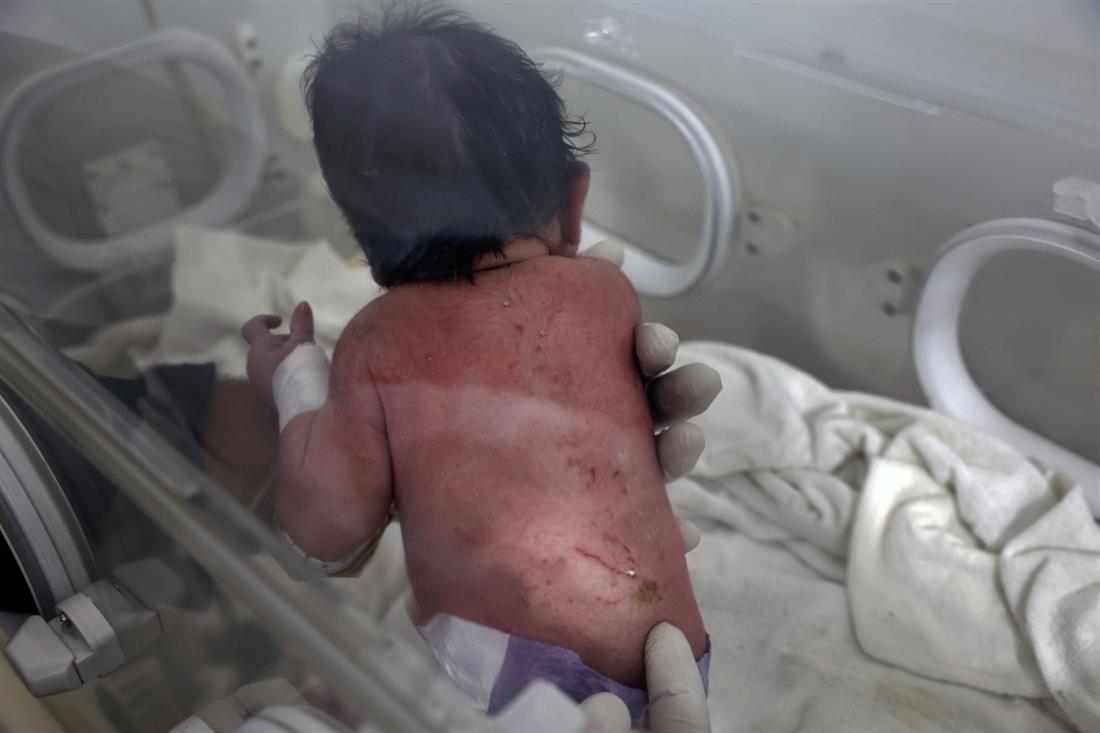 AP -  Συρία - σεισμός - νεκροί - μωρό