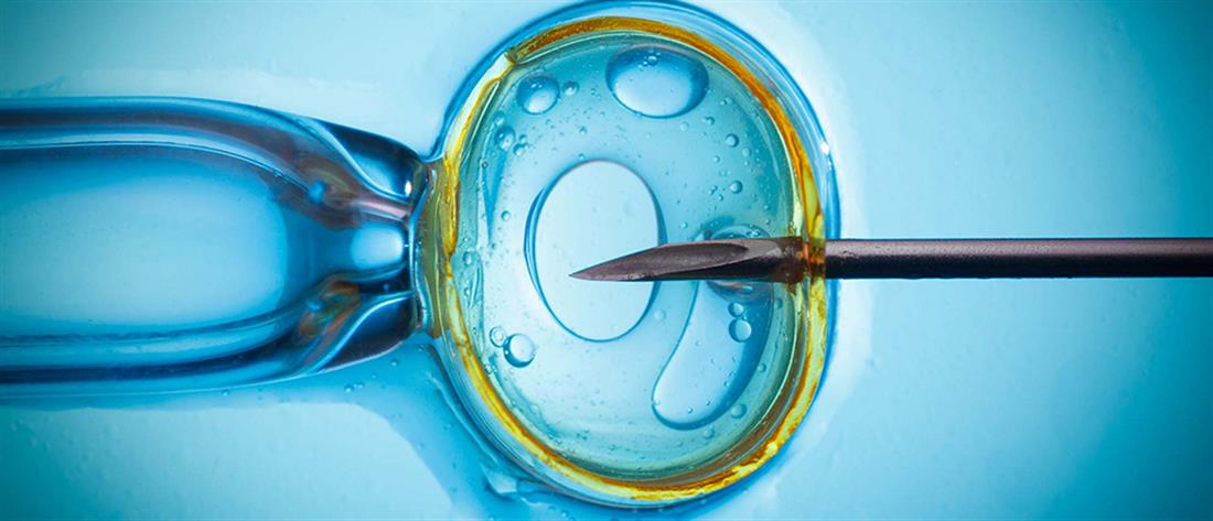  Εξωσωματική γονιμοποίηση: Φυσικός κύκλος ή κλασσική διέγερση ωοθηκών;