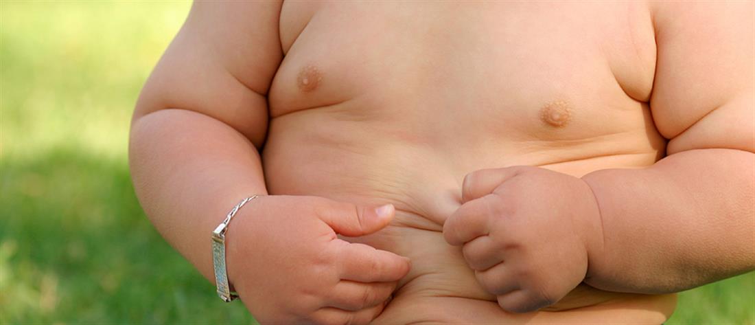 Παιδική Παχυσαρκία - Μωρό