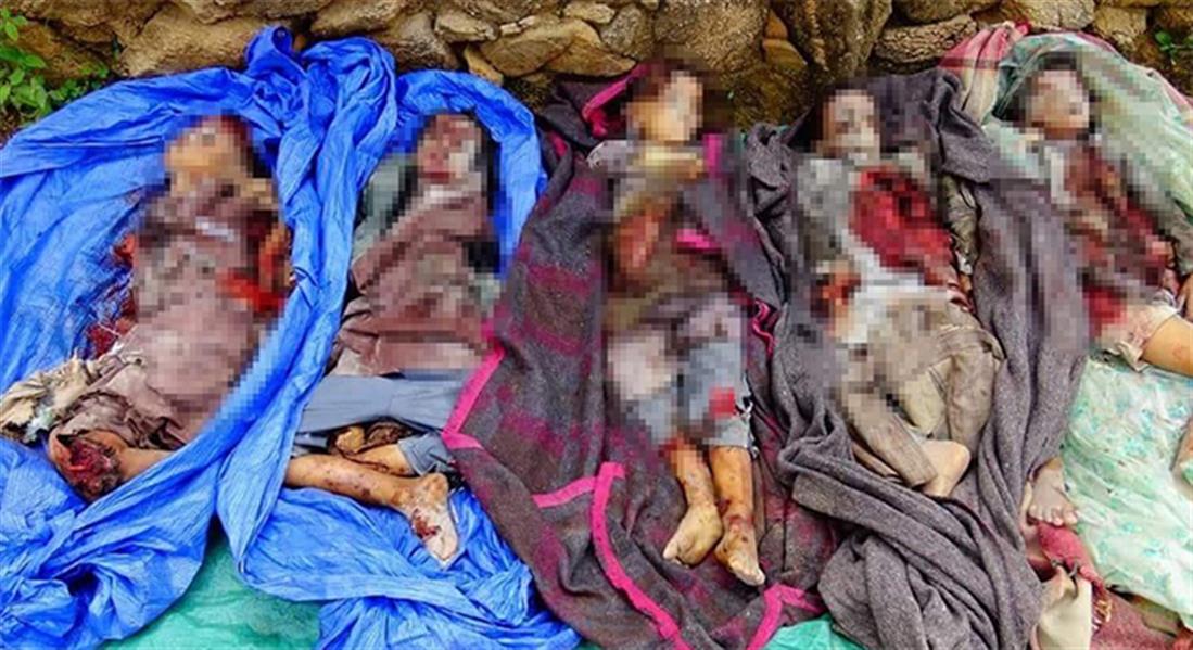 Υεμένη - Παιδιά - τραυματίες - αεροπορική - επιδρομή
