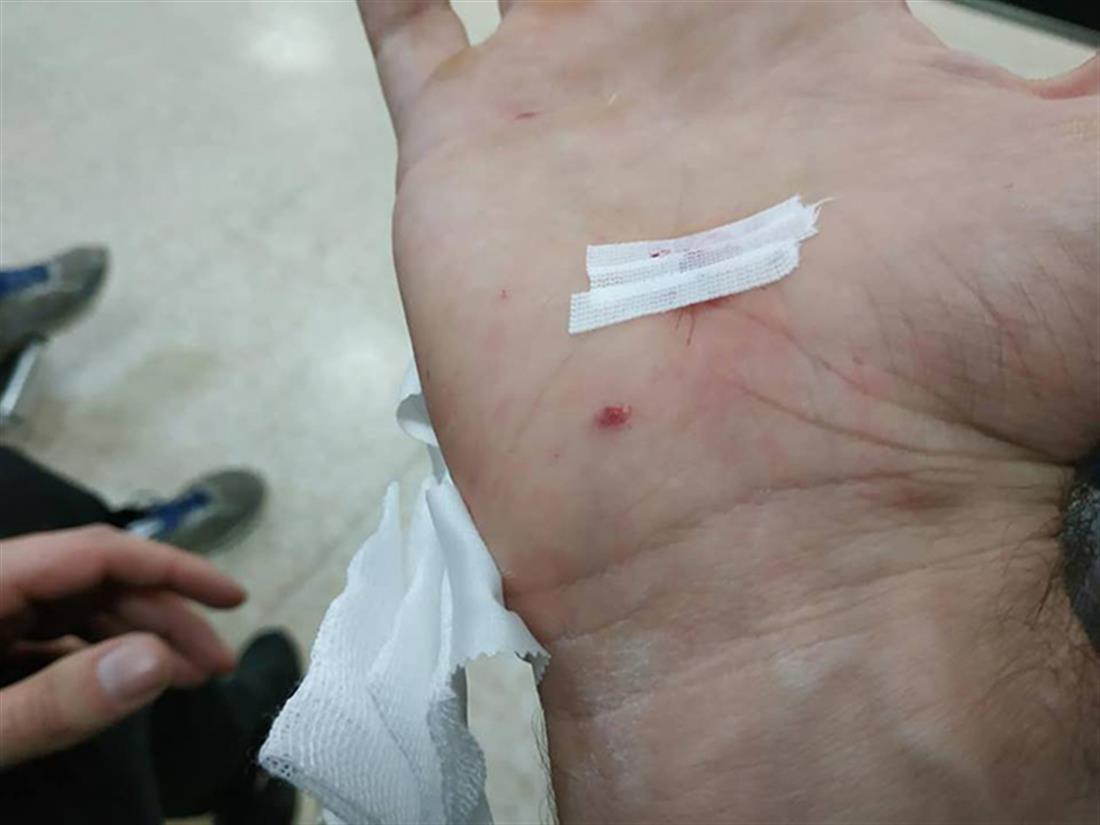 Τραυματίες αστυνομικοί - επίθεση με μολότοφ - Ομόνοια